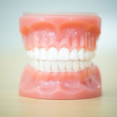 Invisalign for Adults - NKC Dental