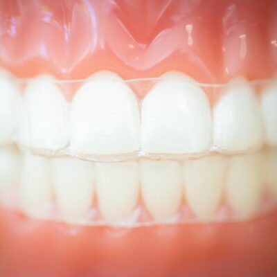 Tech-Typodonts-Kanning-Orthodontics-2020-Kansas-City-Missouri-Orthodontist-47-400x400 Clarity Clear Aligners  - Braces and Invisalign in Liberty, Missouri - Kanning Orthodontics